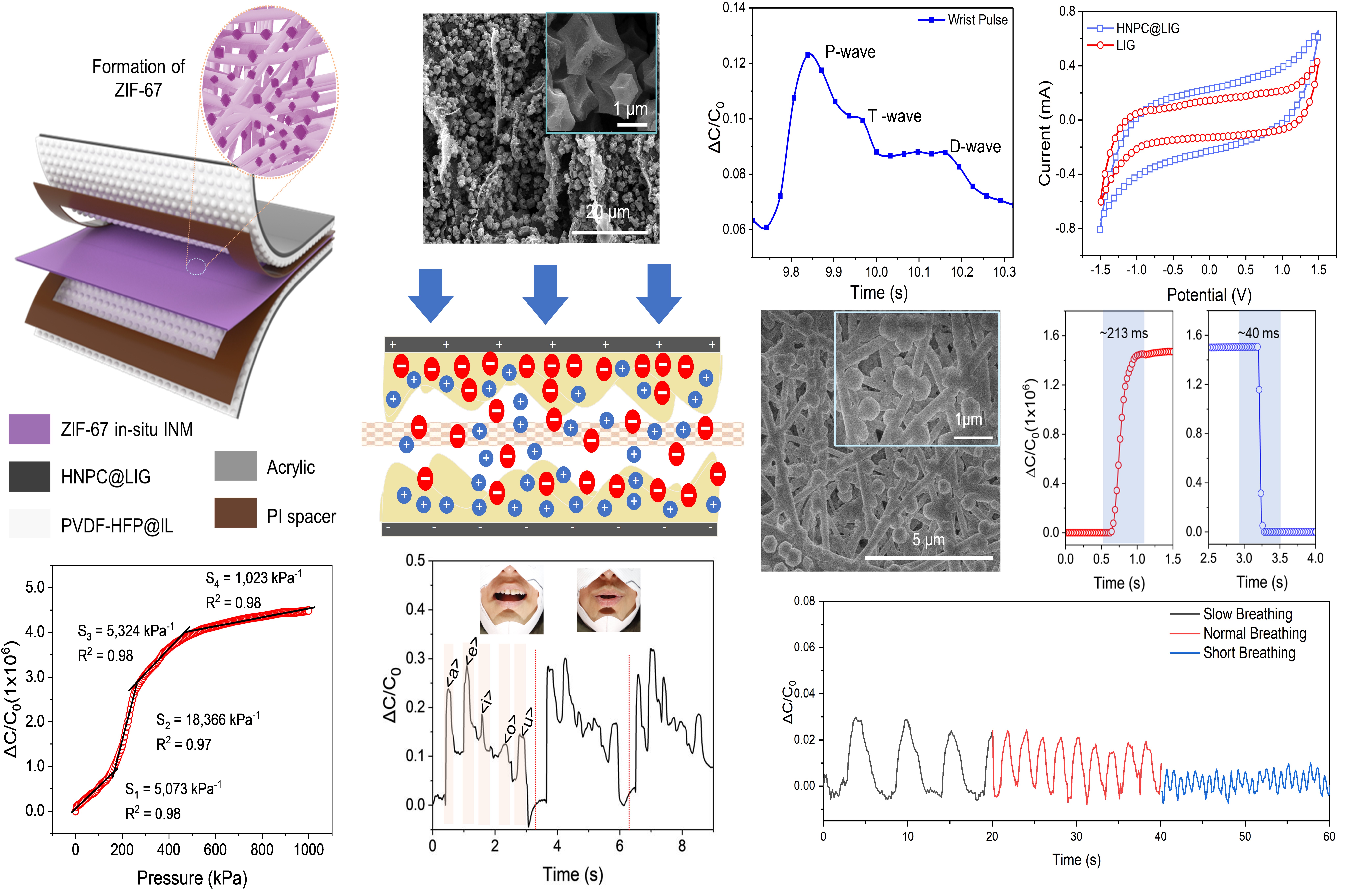 ZIF-67–Grown Ionic Nanofibrous Membrane Separator-Based Ultra-Sensitive Ionotronic Pressure Sensor for Physiological Signal Monitoring and Ergonomic Assistance