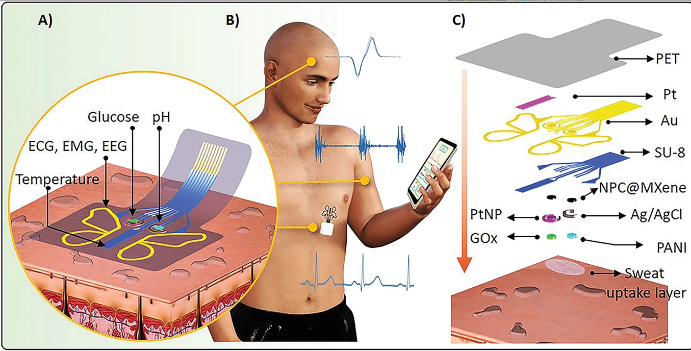 A Nanoporous Carbon‐MXene Heterostructured Nanocomposite‐Based Epidermal Patch for Real‐Time Biopotentials and Sweat Glucose Monitoring